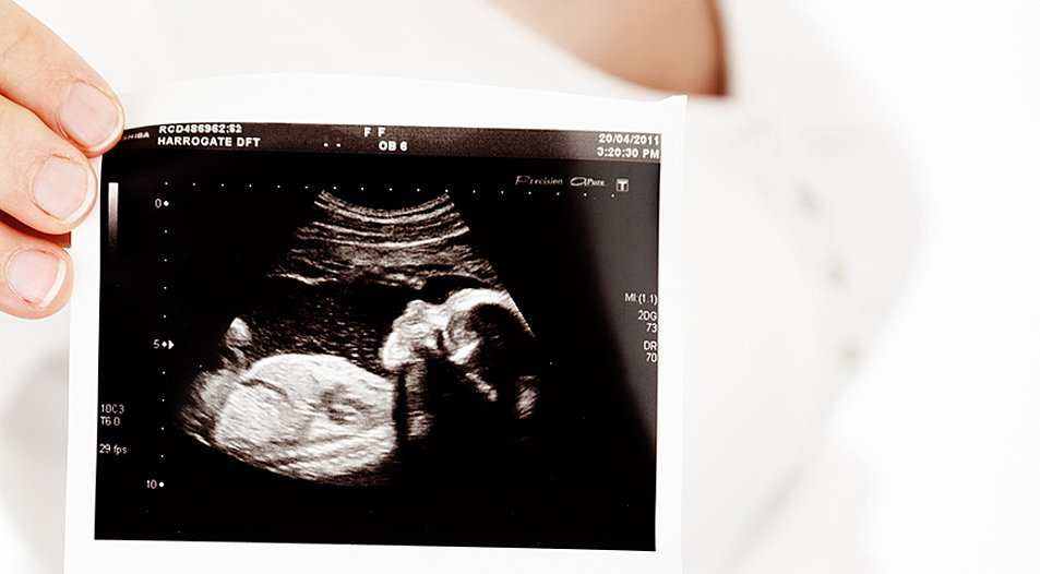 Ein Ultraschallbild eines Embryos. Symbolbild: pixabay.com
